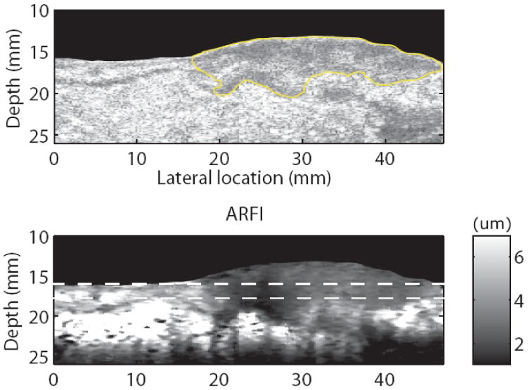 FIG. 10