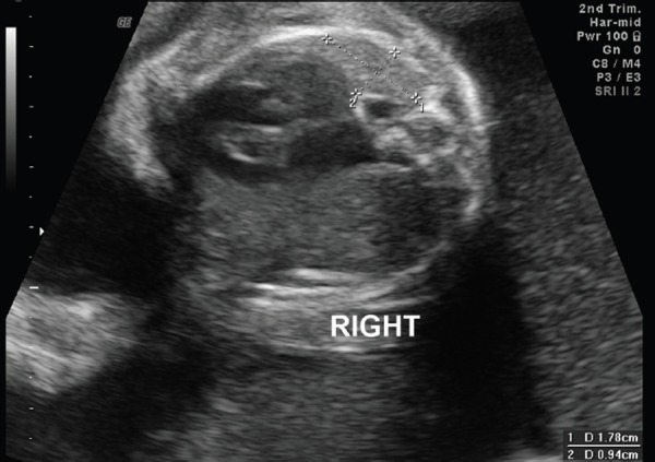 Figure 4a