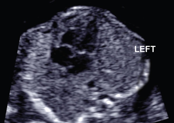 Figure 2a