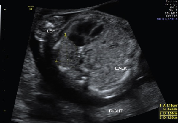 Figure 5