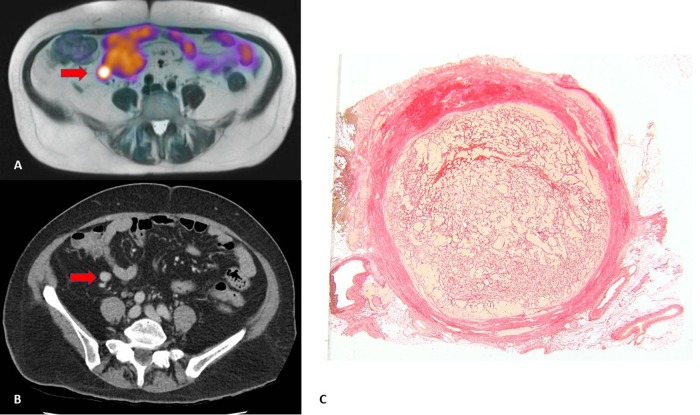 Fig. 2