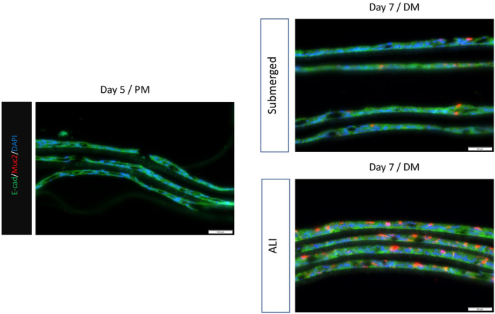 FIGURE 11