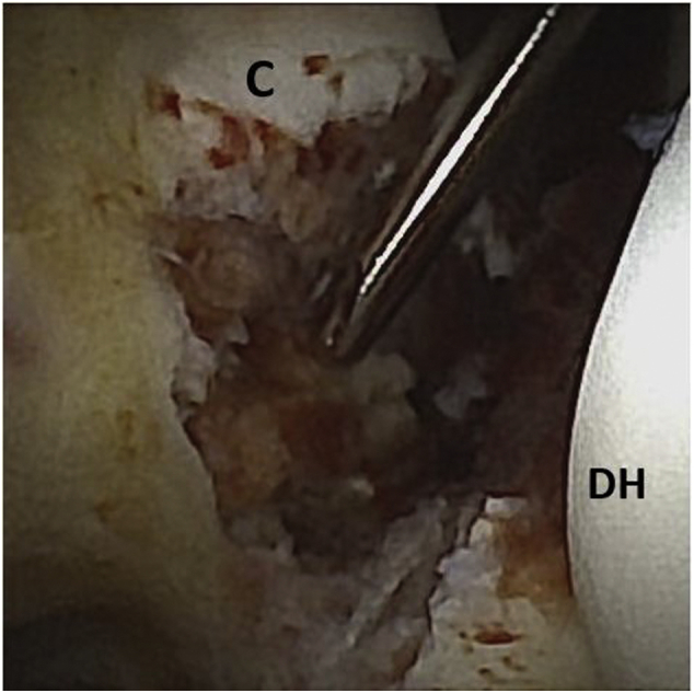 Fig 3