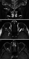 Fig. 16