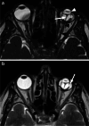 Fig. 14