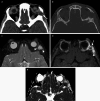 Fig. 33