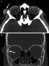 Fig. 34
