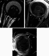 Fig. 11