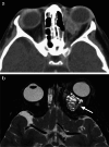 Fig. 20