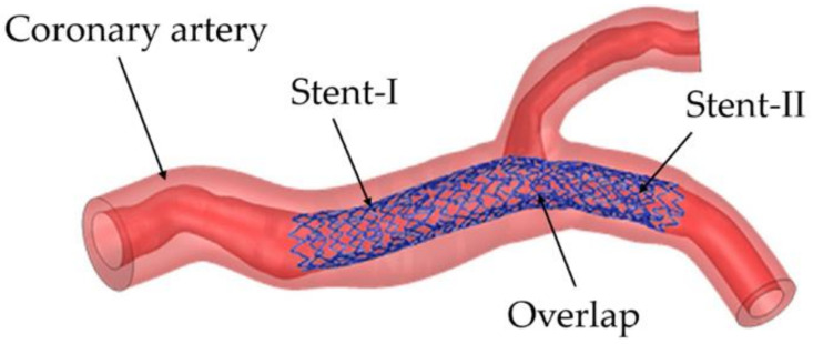 Figure 21