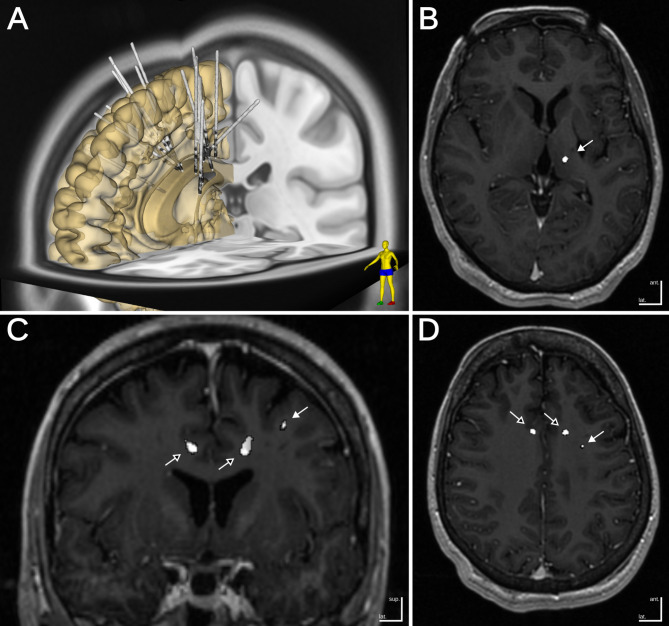 Fig. 2