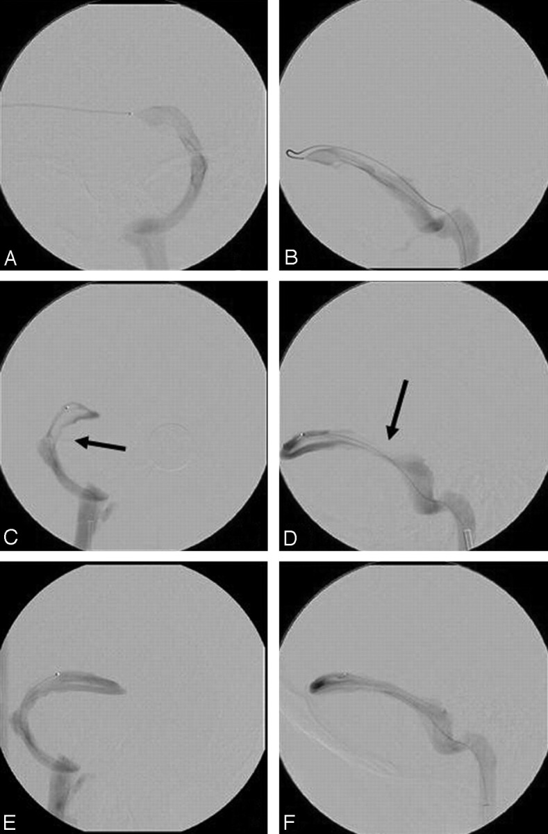 Fig 2.