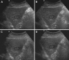 Fig. 1