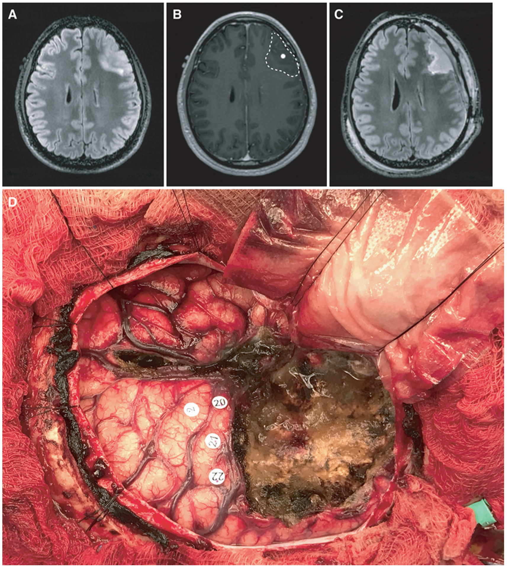 FIG. 5.