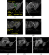 Fig. 13