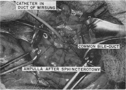 Fig. 13