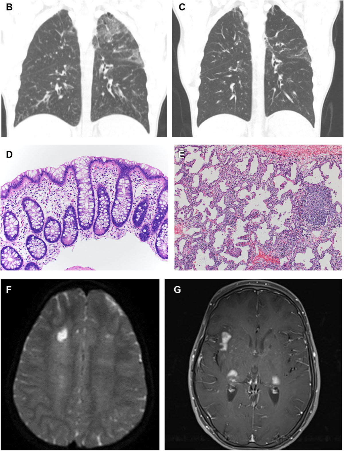 FIG 4.