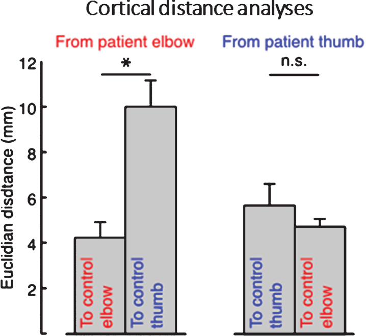 Fig.2