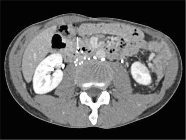 Fig. 2