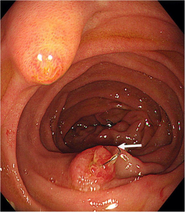 Fig. 1