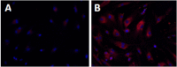 Fig. (1)