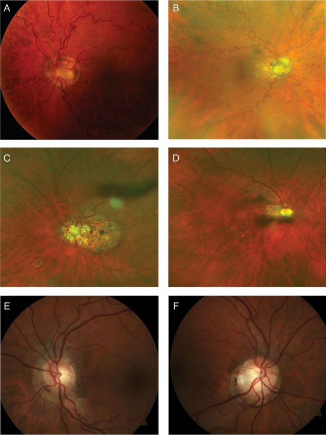 Fig. 2.