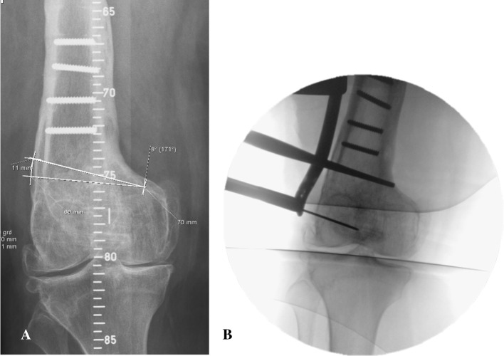 Fig. 2