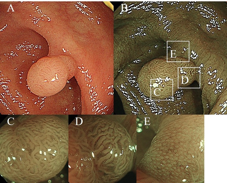 Fig 1