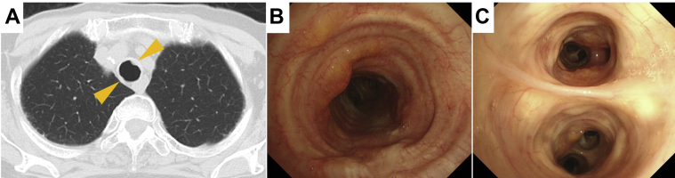 Figure 2