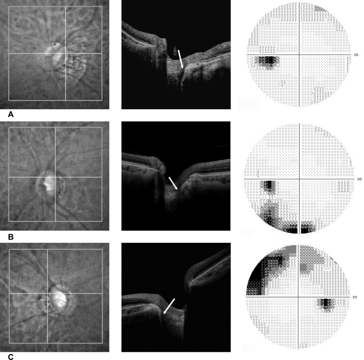 Fig 3