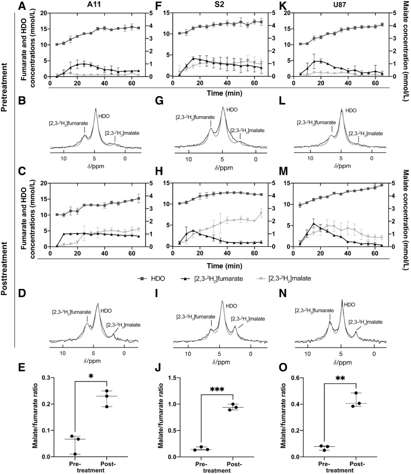 Figure 2. 2H MR spectroscopy measurements of labeled fumarate, malate, and water concentrations in A11 (A–E), S2 (F–J), and U87 (K–O) tumors. Tumor spectra were acquired before and 48 hours after the last chemo-radiotherapy treatment (temozolomide 100 mg/kg, 20 Gy in total, 5 Gy per fraction). Sum of 12 2H spectra recorded over 60 minutes from A11 (B, D), S2 (G, I), and U87 (L, N) tumors. Injection of [2,3-2H2]fumarate (1 g/kg) started 5 minutes after the start of acquisition of the first spectrum. The peaks were fitted individually using prior knowledge. [2,3-2H2]malate/[2,3-2H2]fumarate ratios before and 48 hours after the last chemo-radiotherapy treatment of A11 (E) (n = 3; *, P = 0.0439, paired two-tailed t test), S2 (J) (n = 3; ***, P = 0.0006, paired two-tailed t test) and U87 (O) (n = 3; **, P = 0.0061, paired two-tailed t test). Data are presented as mean ± SD.