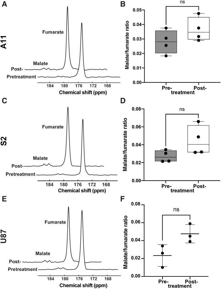 Figure 5. 13C MR spectra acquired following intravenous injection of hyperpolarized [1,4-13C2,2,3-2H2]fumarate. Summed spectra showing flux of hyperpolarized 13C label between [1,4-13C2,2,3-2H2]fumarate (177.2 ppm) and [1,4-13C2,2,3-2H2]malate (182.2, 183.6 ppm) were acquired from an 8-mm tumor slice over a period of 180 seconds starting from the time of injection. Spectra were acquired from A11 (A), S2 (C), and U87 (E) tumors before and at 48 hours after the last chemo-radiotherapy session. Malate/fumarate signal ratios in A11 [(B); n = 4, paired two-tailed t test], S2 (D) (n = 4, paired two-tailed t test), and U87 [(F); n = 3, paired two-tailed t test] tumors pre- and posttreatment. The ratios were obtained from the summed spectra.