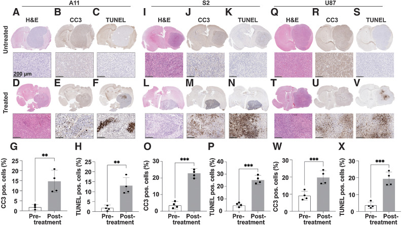 Figure 4. Histologic assessment of tumor cell death 48 hours following chemo-radiotherapy treatment. Representative sections of A11 (A–F), S2 (I–N), and U87 (Q–V) tumors stained with H&E (A, D, I, L, Q, T). The upper panels show the whole brain section containing the tumor and the lower panels a 10x magnification of part of the tumor area. The sections were co-stained for CC3 (B, E, J, M, R, U) and TUNEL (C, F, K, N, S, V). The percentage of CC3 (G, O, W) and TUNEL (H, P, X) positive cells pretreatment and 48 hours after the completion of treatment is shown for A11 (G, H), S2 (O, P), and U87 (W, X) tumors (n = 4 per group, drug- and untreated). Data are shown as mean ± SD. **, P < 0.01; ***, P < 0.001.