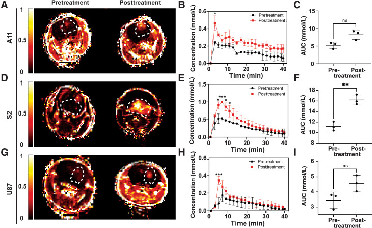 Figure 6. DCE MRI measurements of perfusion in A11 [n = 3; (A–C)], S2 [n = 3; (D–F)], and U87 [n = 3; (G–I)] tumors before and after treatment. Representative color intensity maps of mean contrast agent concentration over the first three minutes following injection in A11 (A), S2 (D), and U87 (G) tumors. The locations of the tumors are outlined by dotted white lines. Estimated contrast agent concentration in tumor tissue at the indicated times after intravenous injection before and 48 hours following the last chemo-radiotherapy treatment of A11 (B), S2 (E), and U87 (H) tumors. Data are shown as mean ± SD; *, P < 0.05; ***, P < 0.001. The area under the uptake curve (AUC) showed an increase in contrast agent uptake in S2 tumors (**, P = 0.0024, paired two-tailed t test) following treatment (F), while there were no significant differences in A11 (C) and U87 (I) tumor-bearing animals. Data are presented as mean ± SD.