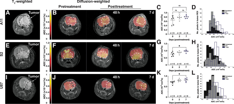 Figure 7. Diffusion-weighted imaging of A11, S2, and U87 tumors before and after treatment. Representative T2-weighted axial slices from reference 1H images acquired at 9.4 T from an A11 tumor (A), S2 tumor (E), and U87 tumor posttreatment (I) at 7 days after treatment. The locations of the tumors are outlined by dotted black lines. Representative diffusion images, in false color, overlaid on the corresponding T2-weighted images acquired from A11 (B), S2 (F), and U87 (J) tumors before and at 48 hours and 7 days after the last chemo-radiotherapy treatment. The locations of the tumors are outlined by dotted white lines. The underlying T2-weighted images acquired at 7 days after treatment are the same was those shown in A, E, and I and the underlying image shown in panel F at 48 hours posttreatment is the same as that shown in Fig. 3J. The 2H and diffusion-weighted images were acquired in the same imaging session as the T2-weighted images. Mean ADC measured along the slice-selective direction before and at 2 and 7 days after the last chemo-radiotherapy treatment in A11 [n = 6; (C)], S2 [n = 6; (G)], and U87 [n = 6; (K)] tumors. Histograms of ADC values over all the animals imaged in A11 (D), S2 (H), and U87 (L) tumors. *, P < 0.05.