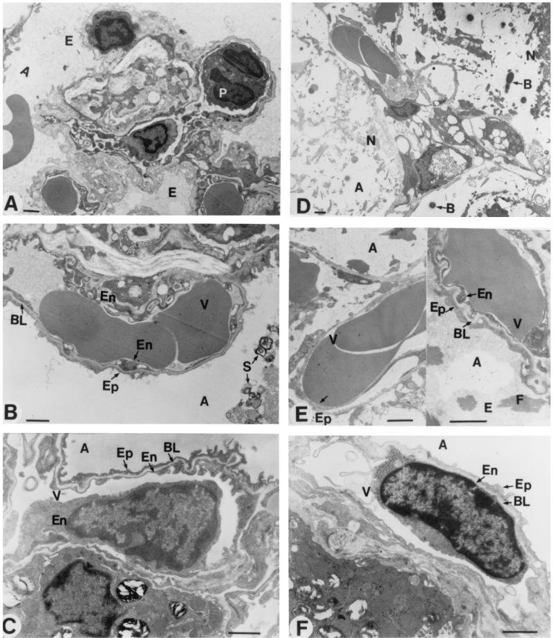 FIG. 11.