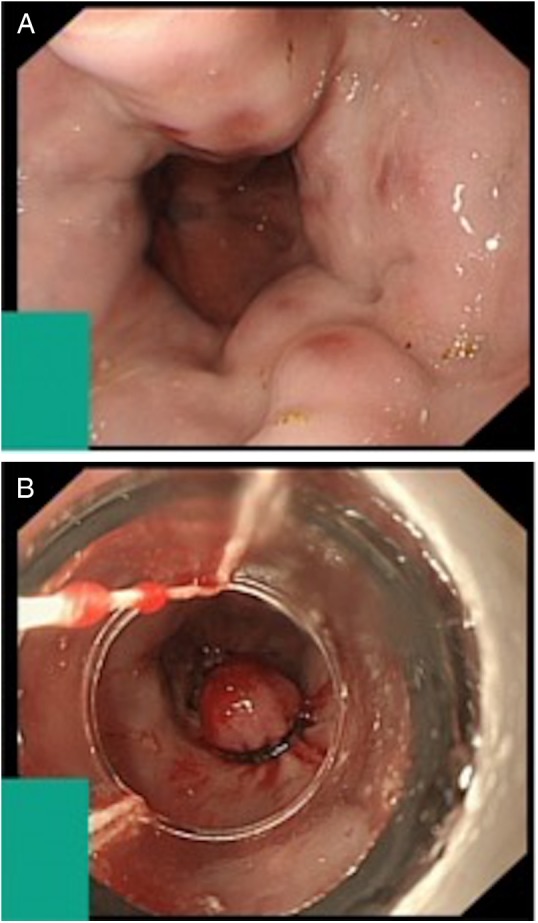 Figure 1