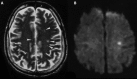 FIG 1