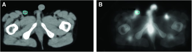 FIG. 1.