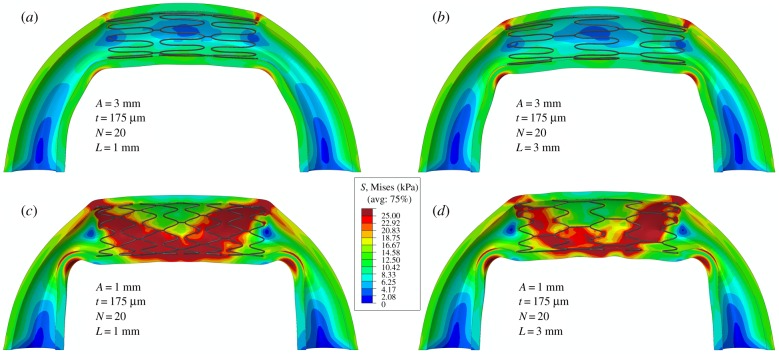 Figure 11.