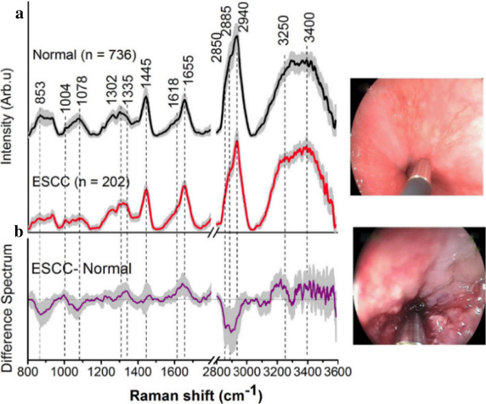 Fig. 12