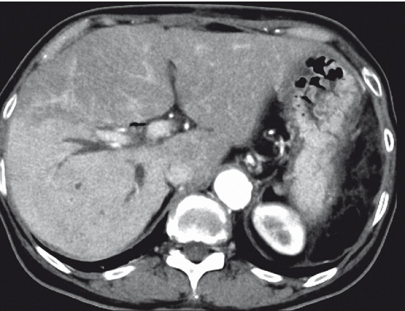 Fig. 1