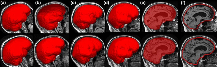 Figure 10