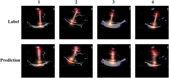 FIGURE 4