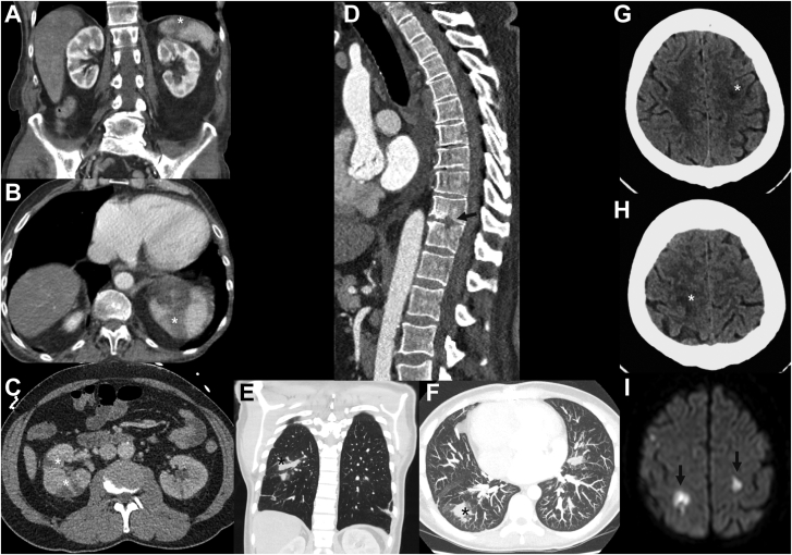 Figure 12