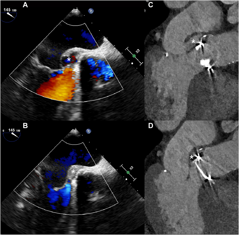 Figure 11