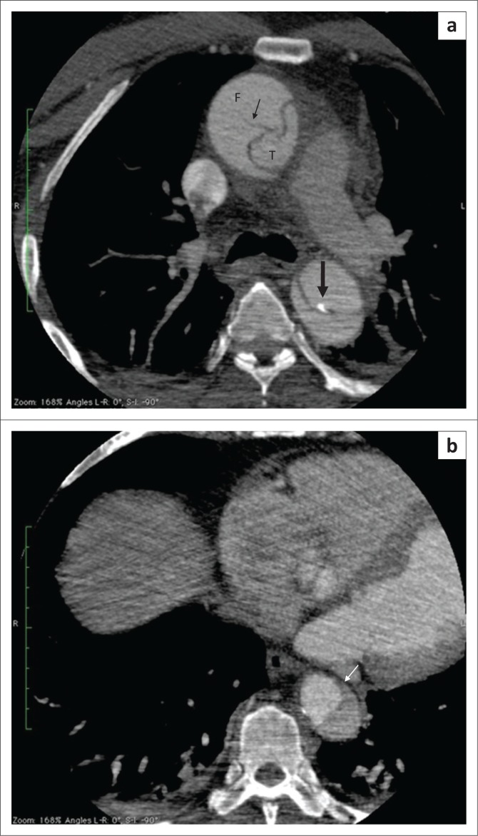 FIGURE 3