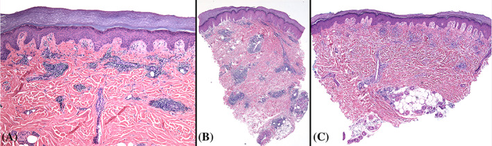 FIGURE 3