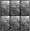 Figure 26