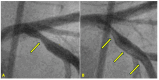 Figure 23